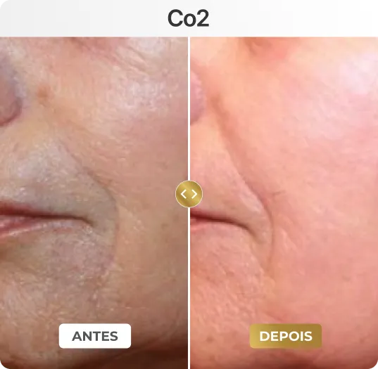 co7